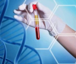 MERCREDI SANTÉ/ ÉLECTROPHORÈSE DE L’HÉMOGLOBINE : Quand l’amour rencontre la responsabilité